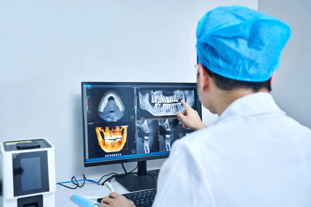 Best Emergency Dental Extractions in Union Park, FL