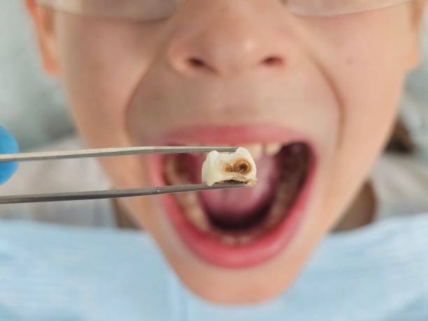 Emergency Dental Services for Seniors